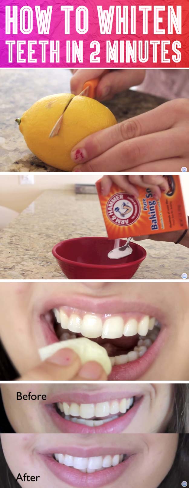 Best Beauty Hacks - Whiten Teeth In 2 Minutes - Easy Makeup Tutorials and Makeup Ideas for Teens, Beginners, Women, Teenagers - Cool Tips and Tricks for Mascara, Lipstick, Foundation, Hair, Blush, Eyeshadow, Eyebrows and Eyes - Step by Step Tutorials and How To #beautyhacks #beautyideas #makeuptutorial #makeuphakcs #makeup #hair #teens